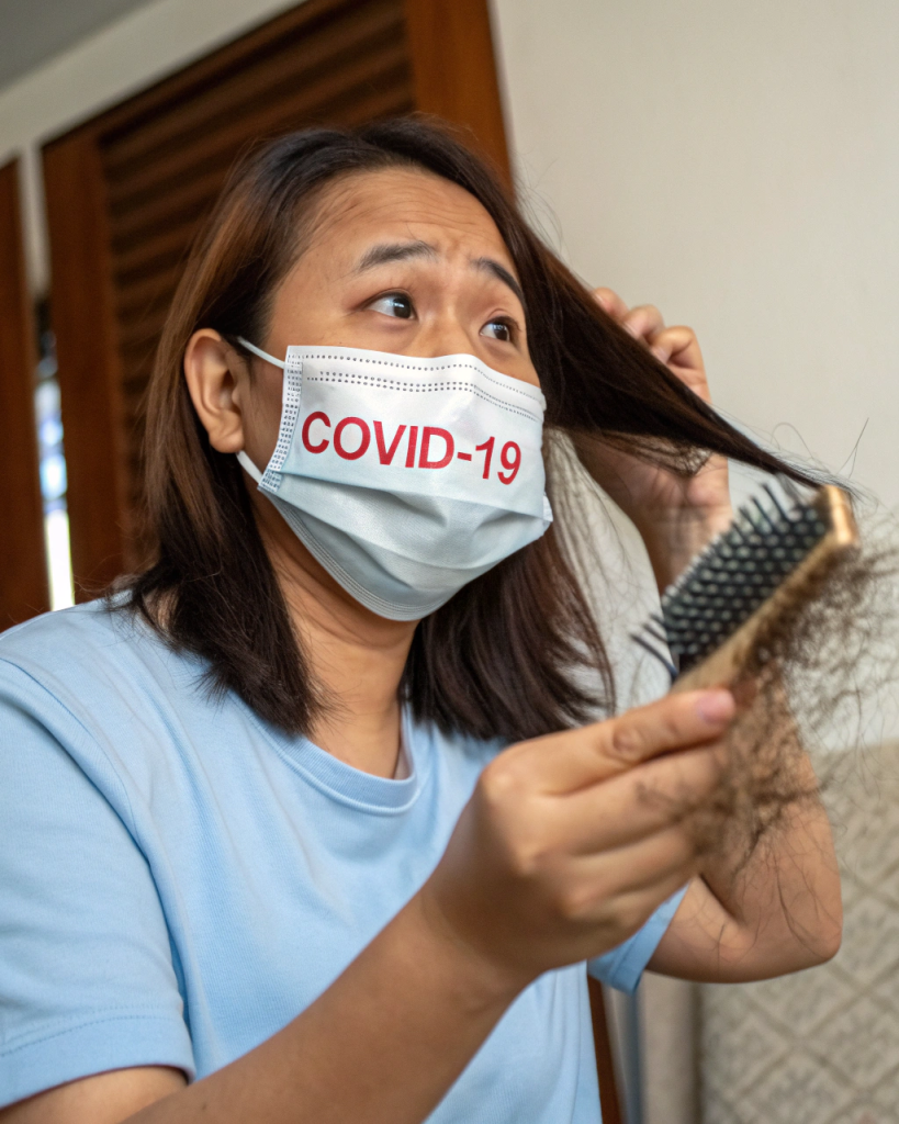 Выпадение волос после Covid-19