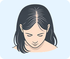 Пересадка волос для женщин