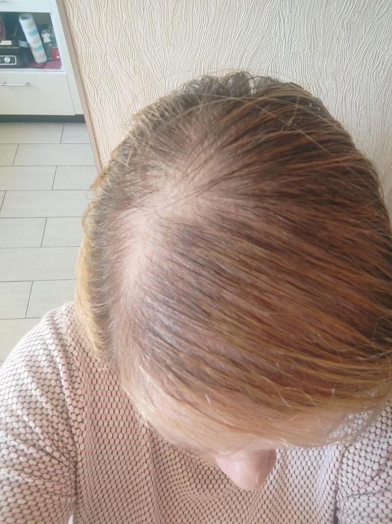 posle