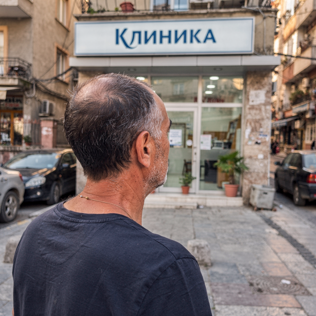 Пересадка волос после Турции: как исправить неудачную трансплантацию
